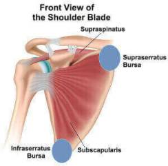 Scapulothoracic Bursitis aka Snapping Scapula Syndrome