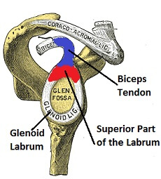 SLAP Tear: Causes, Symptoms & Treatment of Shoulder Labrum Tear