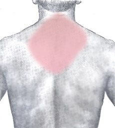 Common location of pain with a heart attack - upper back, between the shoulder blades