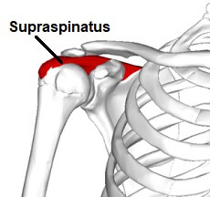 Tendinita supraspinosului este o cauză comună a sindromului de impingement al umărului. Tendonul alunecă prin spațiul subacromial, făcându-l predispus la o fricțiune excesivă care duce la inflamație