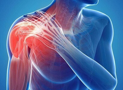 5 common things that could be causing your shoulder pain