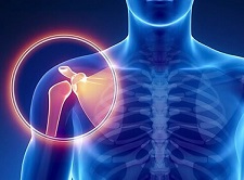 Shoulder Pain Diagnosis Symptom Chart