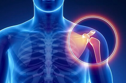 https://www.shoulder-pain-explained.com/images/shoulder-pain-diagnosis.jpg