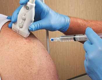 What Is The Best Injection For Shoulder Pain   Shoulder Tendonitis Injection 