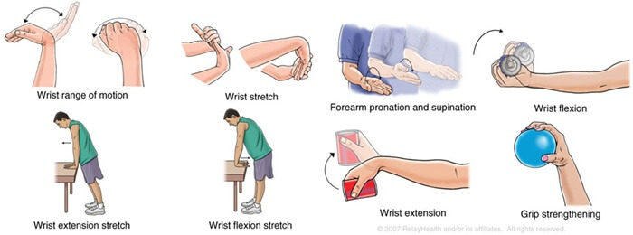 Extensor Carpi Ulnaris Tendonitis: Causes & Treatment